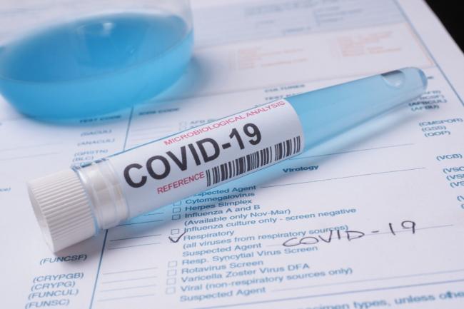 False negative PCR tests part responsible for sharp rise in Covid cases in Wiltshire